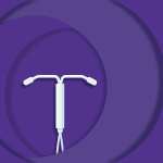 An illustration of an IUD birth control device.