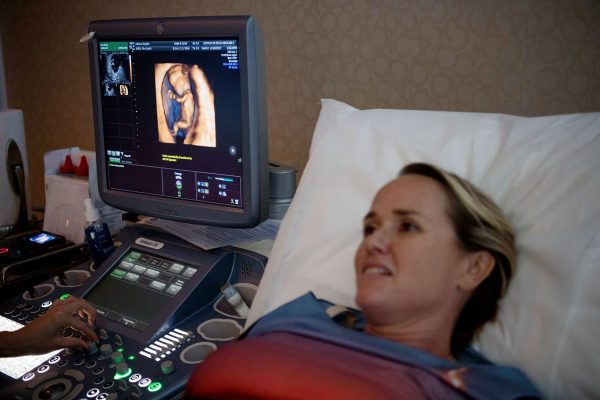 A patient pregnant with with a donor egg and donor sperm is seen getting an ultrasound. On the screen, a fetus can be seen.