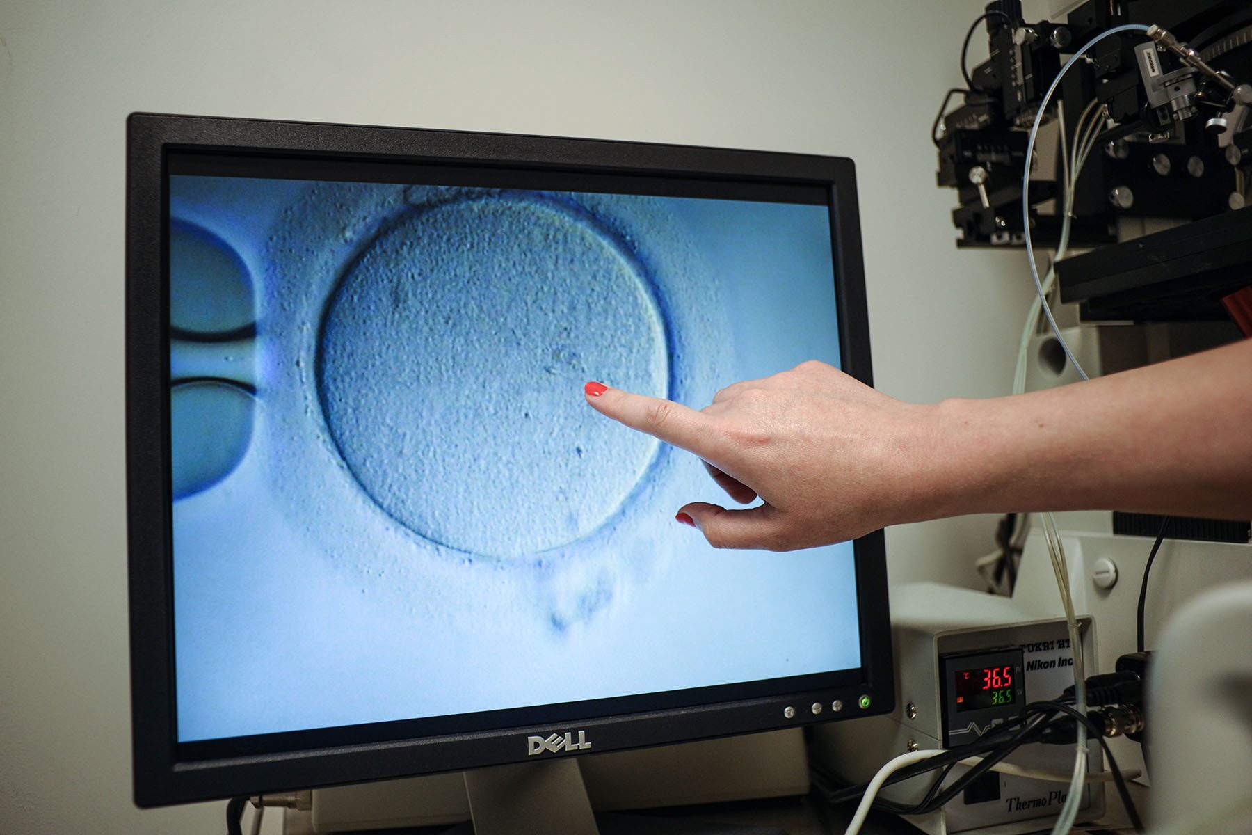 An embryologist point to an Ovocyte on a computer screen after it was inseminated.
