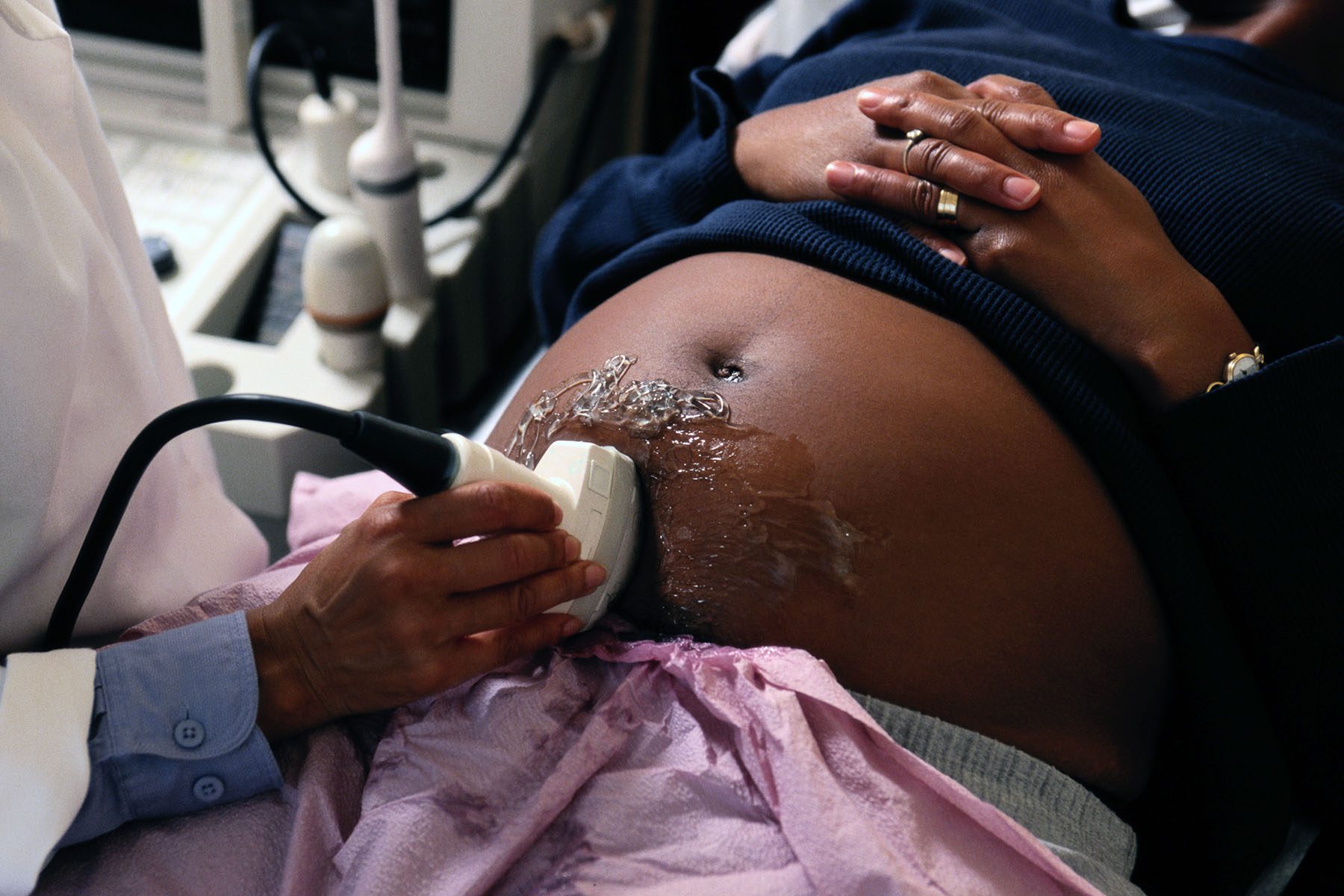 A doctor gives a pregnant person an ultrasound as they lays.