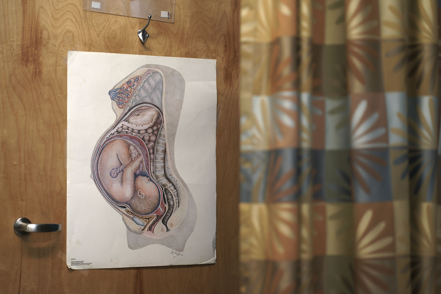 A medical poster showing a baby in the womb hangs in an examination room.