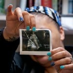 A patient seeking an abortion at Hope Medical Group for Women in Shreveport, Louisiana, holds up her ultrasound photo showing she is just over nine weeks pregnant.