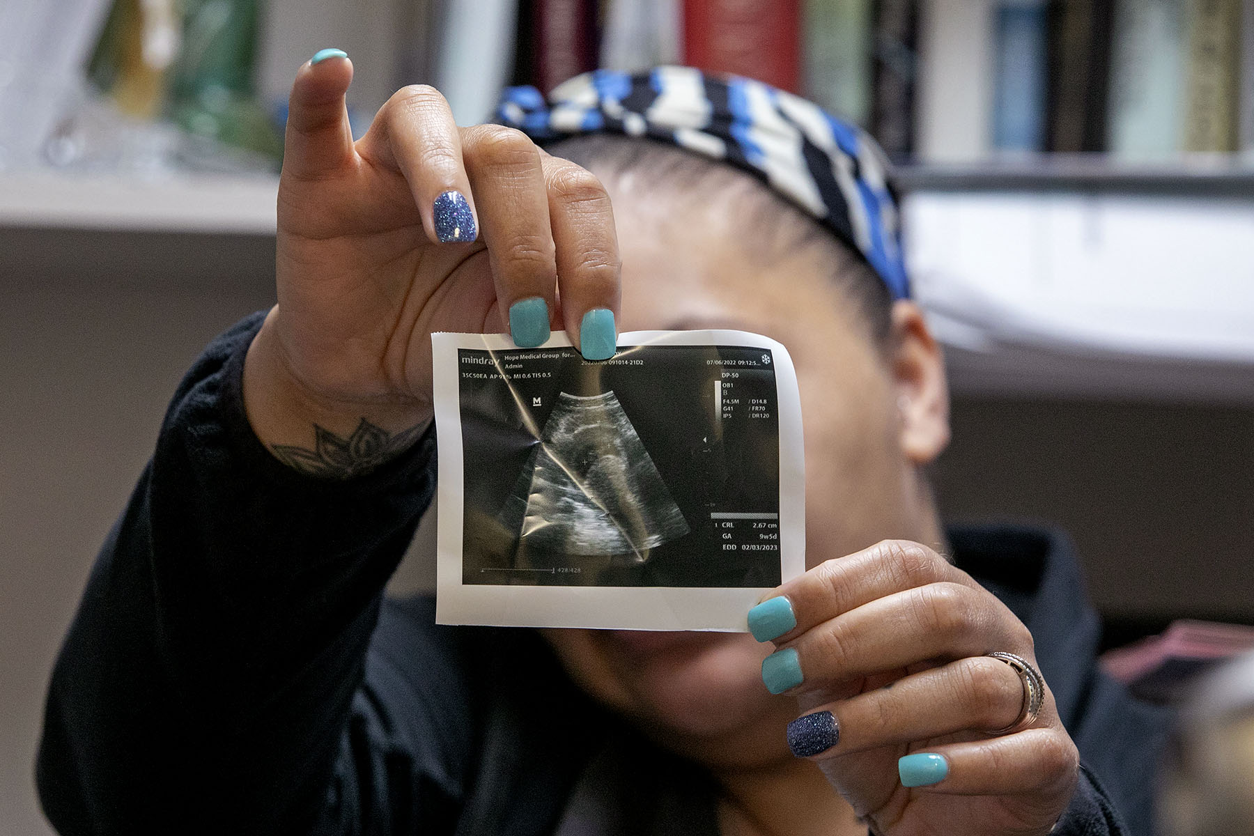 A patient seeking an abortion at Hope Medical Group for Women in Shreveport, Louisiana, holds up her ultrasound photo showing she is just over nine weeks pregnant.