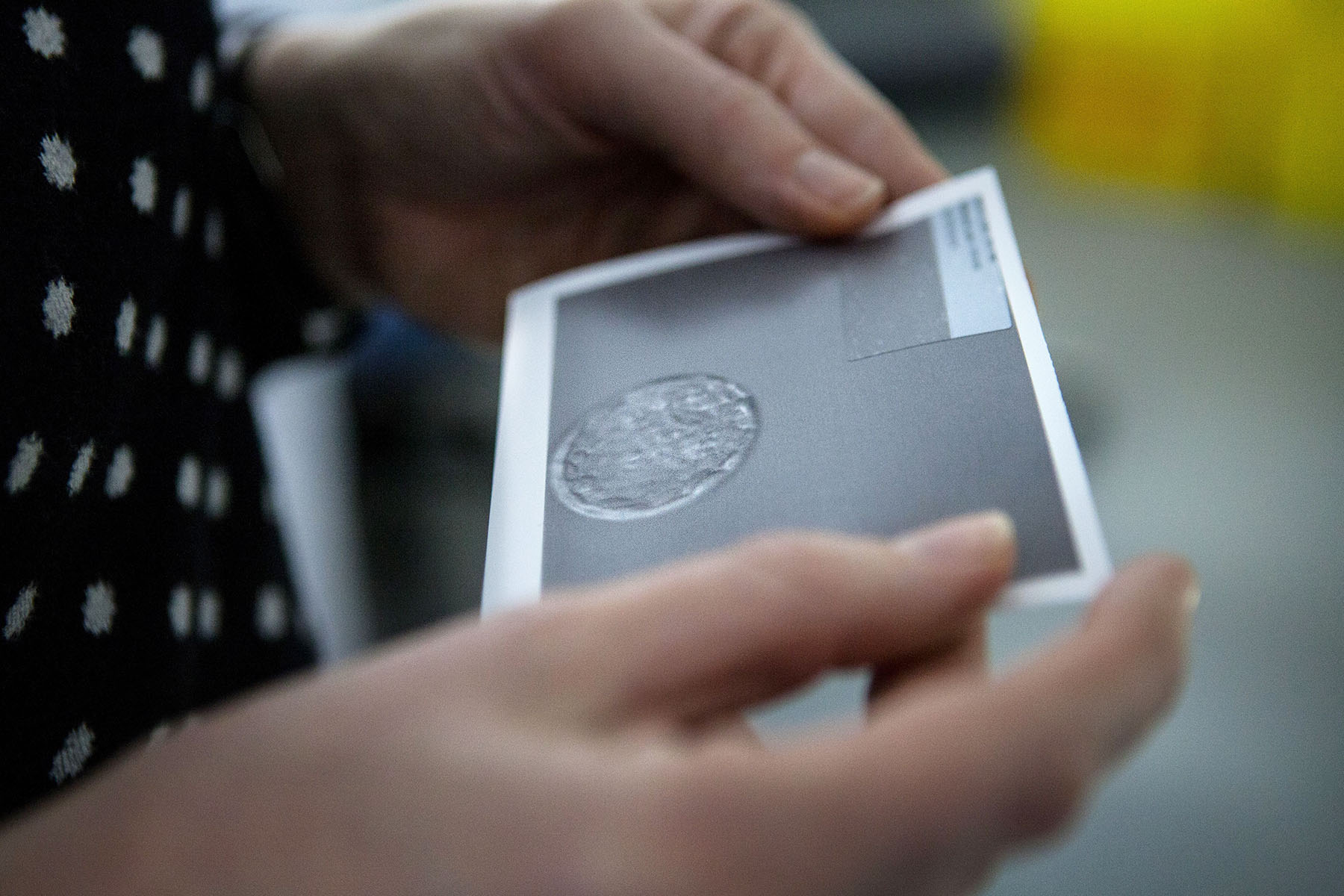 A person looks at a photograph of fertilized egg selected for IVF.