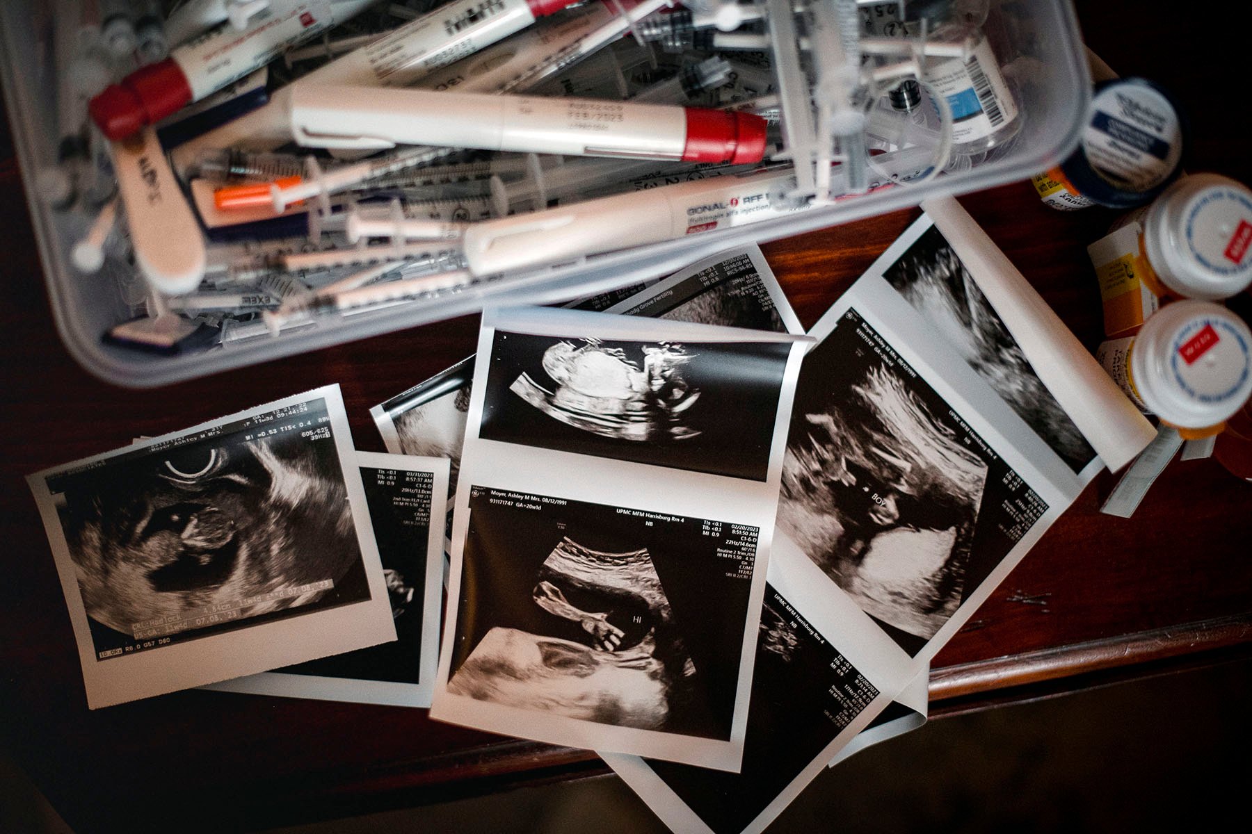 A container full of IVF needles, injections, syringes, old pill bottles and sonograms.