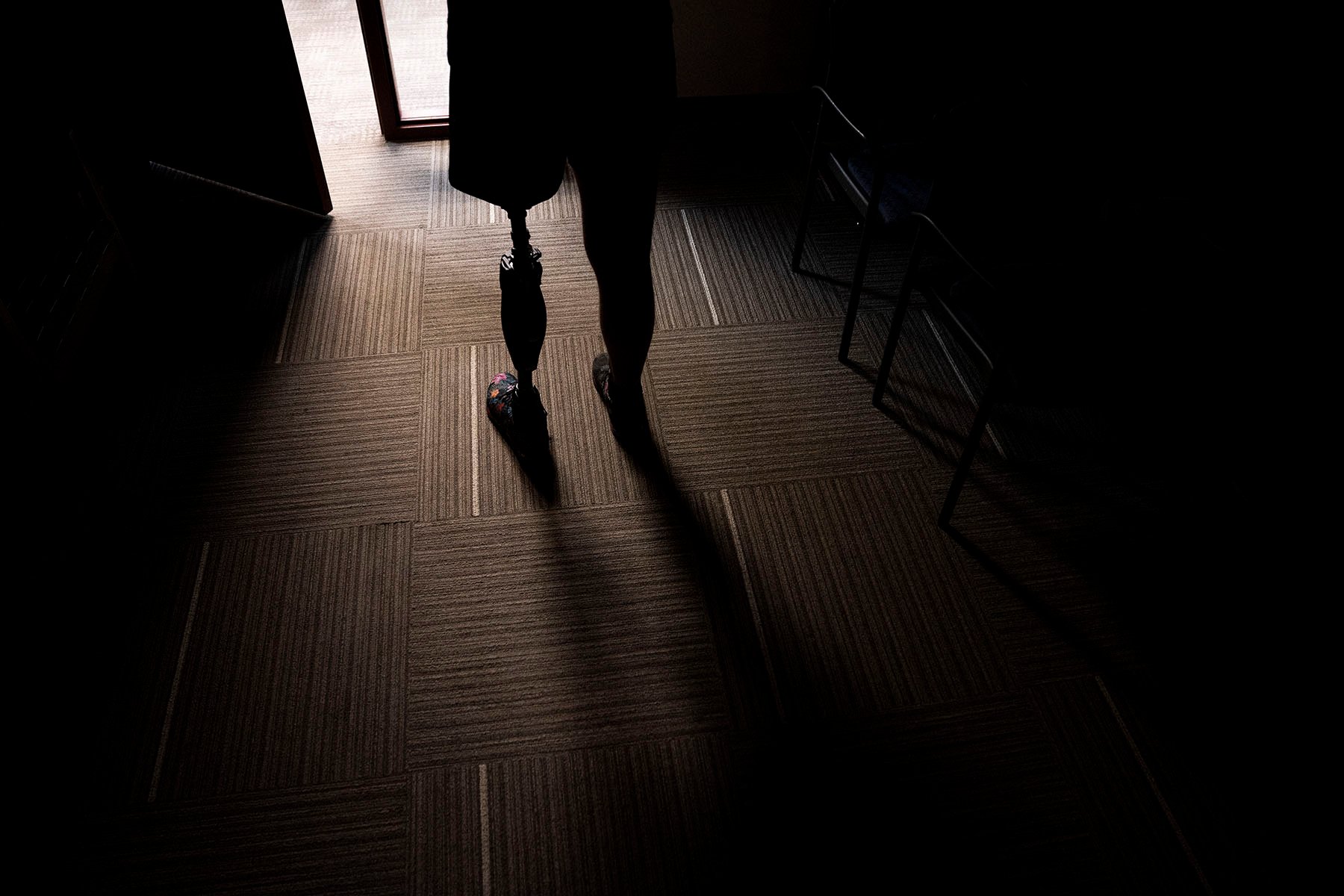 A person wearing a prosthetic leg stands in a doorway.