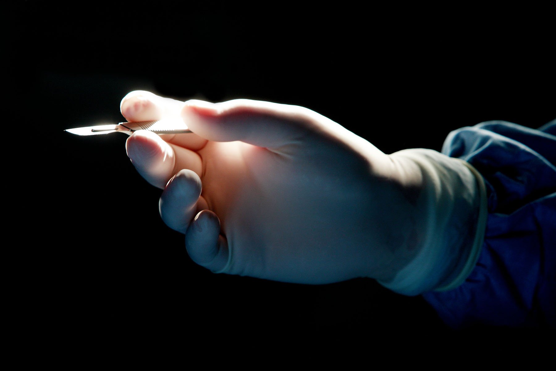 Surgeon holding scalpel during an operation