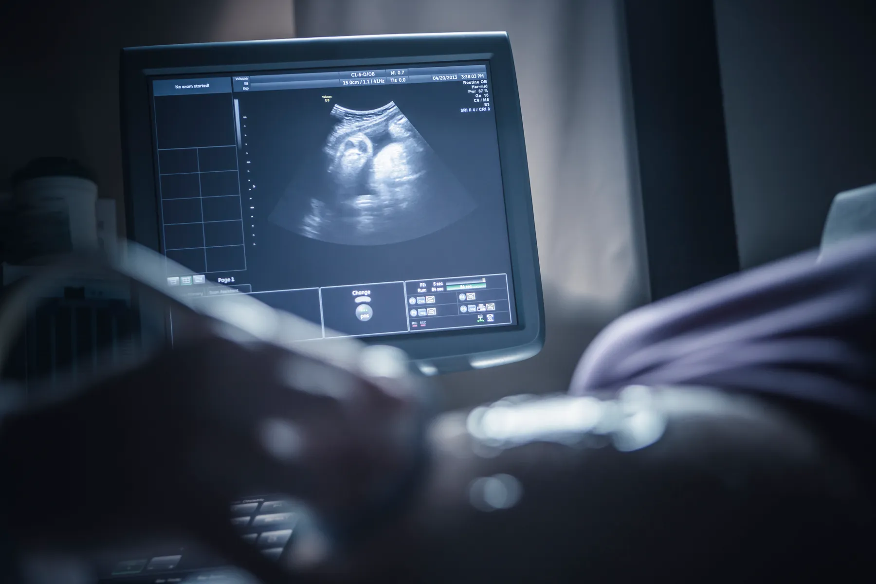 Why abortion opponents are turning their attention to banning surrogacy