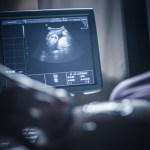 A pregnancy sonogram appears on a screen in a dimly-lit room.